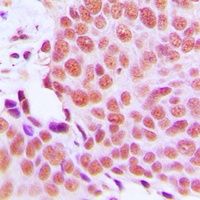 EMP Rabbit Polyclonal Antibody