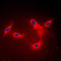 LYPLA1 Rabbit Polyclonal Antibody