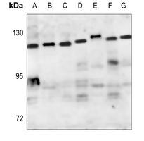 ZHX2 Rabbit Polyclonal Antibody