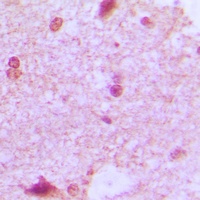 ZHX2 Rabbit Polyclonal Antibody