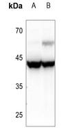 ANKRD1 Rabbit Polyclonal Antibody