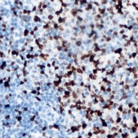 ANKRD1 Rabbit Polyclonal Antibody