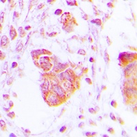 MOV10L1 Rabbit Polyclonal Antibody