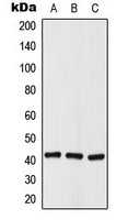 Histone Deacetylase 8 (Phospho-S39) Rabbit Polyclonal Antibody