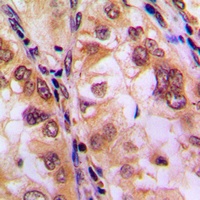Histone Deacetylase 8 (Phospho-S39) Rabbit Polyclonal Antibody