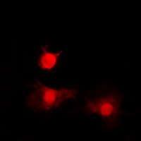 Histone Deacetylase 8 (Phospho-S39) Rabbit Polyclonal Antibody