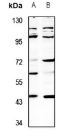 SH3GLB2 Rabbit Polyclonal Antibody