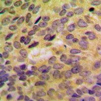 SH3GLB2 Rabbit Polyclonal Antibody