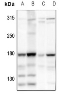 HECW2 Rabbit Polyclonal Antibody