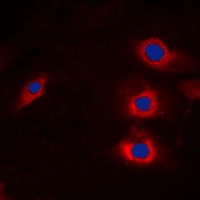 HECW2 Rabbit Polyclonal Antibody