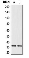 ELOVL1 Rabbit Polyclonal Antibody