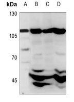 CARD14 Rabbit Polyclonal Antibody