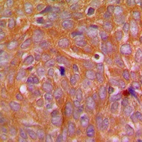 CARD14 Rabbit Polyclonal Antibody