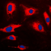 CARD14 Rabbit Polyclonal Antibody