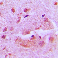 SHARP1 Rabbit Polyclonal Antibody