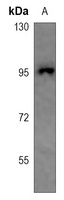 CHSY2 Rabbit Polyclonal Antibody