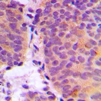 CHSY2 Rabbit Polyclonal Antibody