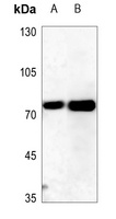 ITPKC Rabbit Polyclonal Antibody