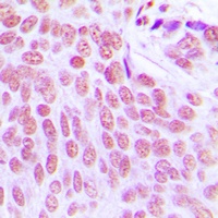 ITPKC Rabbit Polyclonal Antibody