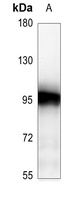 ATRIP Rabbit Polyclonal Antibody