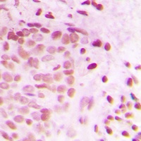 ATRIP Rabbit Polyclonal Antibody