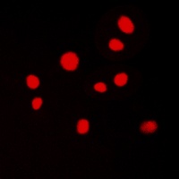ATRIP Rabbit Polyclonal Antibody