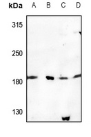 USP32 Rabbit Polyclonal Antibody