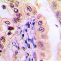 USP32 Rabbit Polyclonal Antibody