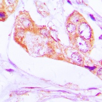 PNPT1 Rabbit Polyclonal Antibody