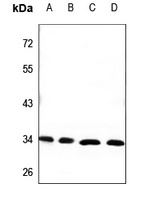 CEACAM21 Rabbit Polyclonal Antibody