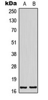 BTF3L4 Rabbit Polyclonal Antibody