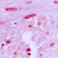 BTF3L4 Rabbit Polyclonal Antibody