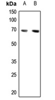 CABLES1 Rabbit Polyclonal Antibody