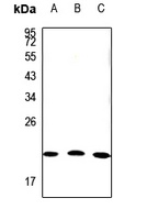 Claudin 19 Rabbit Polyclonal Antibody