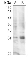 STING Rabbit Polyclonal Antibody