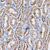 STING Rabbit Polyclonal Antibody