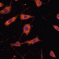 STING Rabbit Polyclonal Antibody