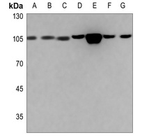 ACTN1/2/3/4 Rabbit Polyclonal Antibody