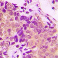 ACTN1/2/3/4 Rabbit Polyclonal Antibody