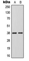 KLF1/5/7 Rabbit Polyclonal Antibody