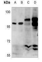 Alpha-adducin (Phospho-S726/713) Rabbit Polyclonal Antibody