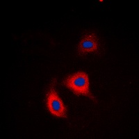 Alpha-adducin (Phospho-S726/713) Rabbit Polyclonal Antibody