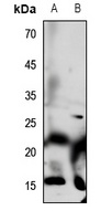 Defensin alpha 1 Rabbit Polyclonal Antibody