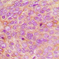 Defensin alpha 1 Rabbit Polyclonal Antibody