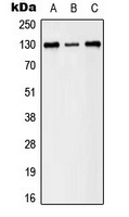 EPHB1/2 (Phospho-Y594/604) Rabbit Polyclonal Antibody