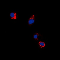 EPHB1/2 (Phospho-Y594/604) Rabbit Polyclonal Antibody