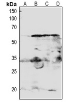 AKT Rabbit Polyclonal Antibody
