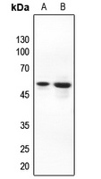 AKT Rabbit Polyclonal Antibody