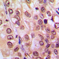 AKT Rabbit Polyclonal Antibody