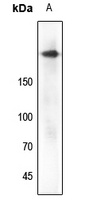 IGF1 Receptor (Phospho-Y1161) Rabbit Polyclonal Antibody